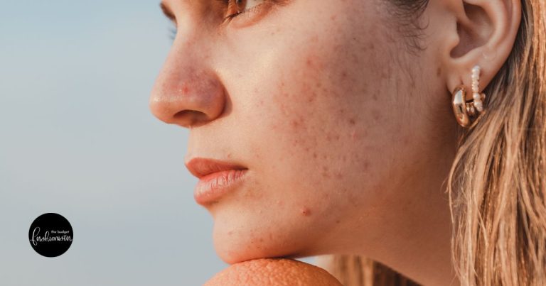 How to get rid of blemishes: A practical guide for clearer skin