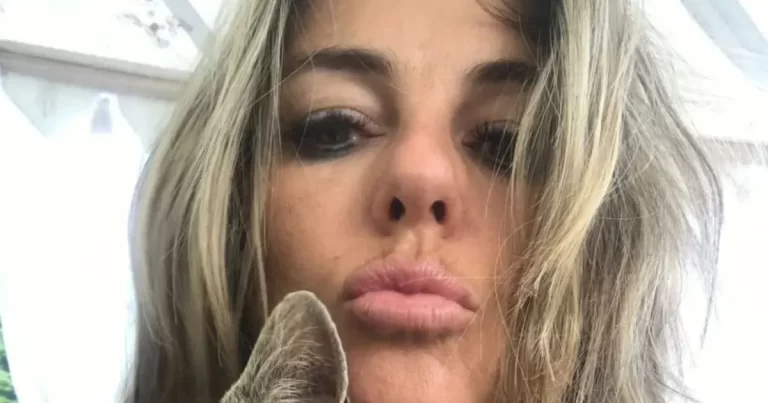 Elizabeth Hurley’s Dress Falls Wide Open, Revealing Her Braless Look