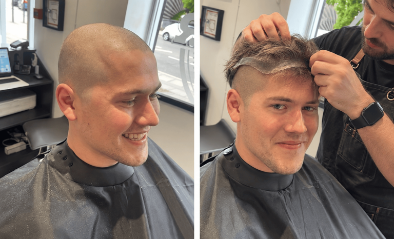 Going Bald? Why Men Choose Hair Systems Over Shaving